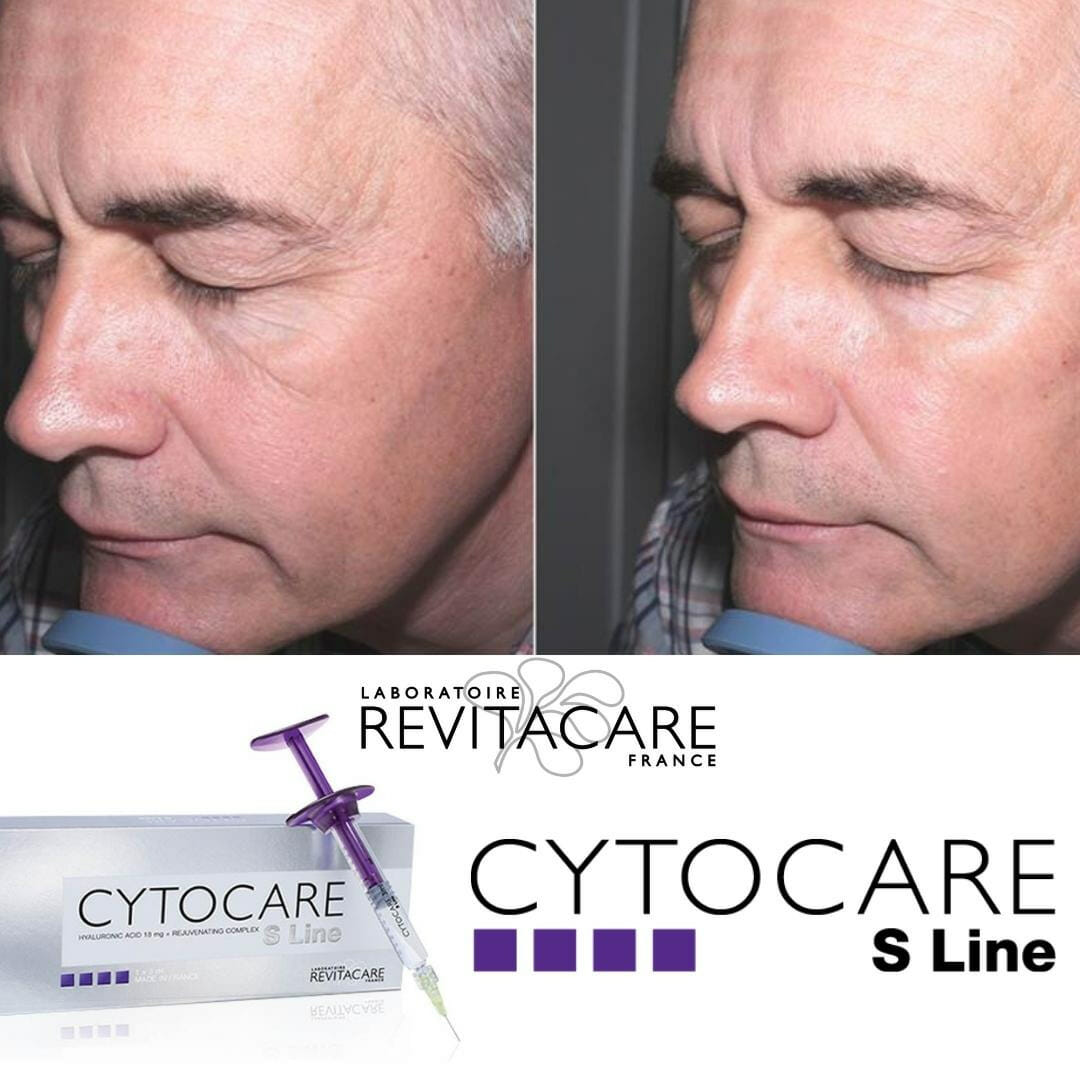 cytocare injection for men الفرق بين البوتوكس والدسبورت